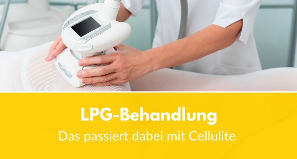 Cellulite: Das passiert bei einer LPG-Behandlung