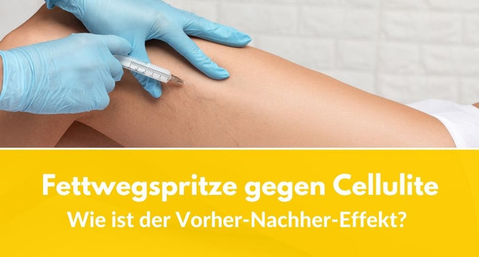 Fettwegspritze gegen Cellulite: Wie ist der Vorher-Nachher-Effekt?