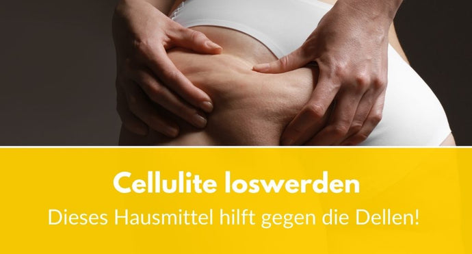 Cellulite loswerden: Dieses Hausmittel hilft gegen die Dellen!