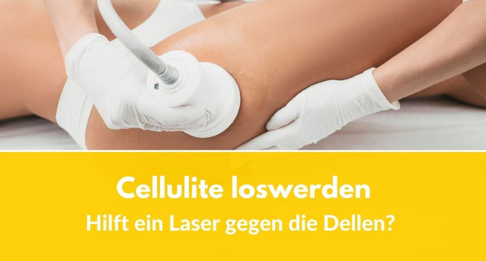 Cellulite loswerden: Hilft ein Laser gegen die Dellen?