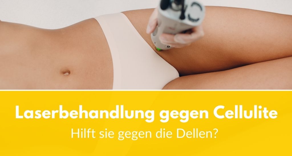 Laserbehandlung gegen Cellulite: Hilft sie gegen die Dellen?